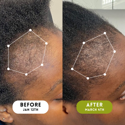 Velura™ Crown Revival Serum