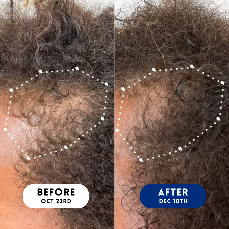 Velura™ Crown Revival Capsules