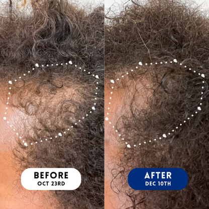 Velura™ Crown Revival Capsules