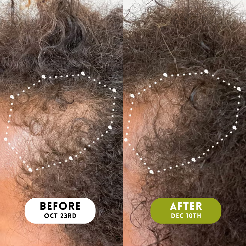 Velura™ Crown Revival Serum