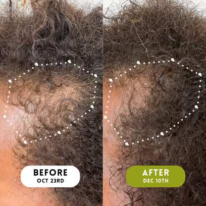 Velura™ Crown Revival Serum